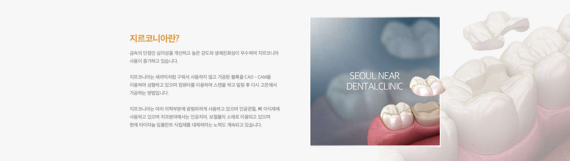 심미 보철