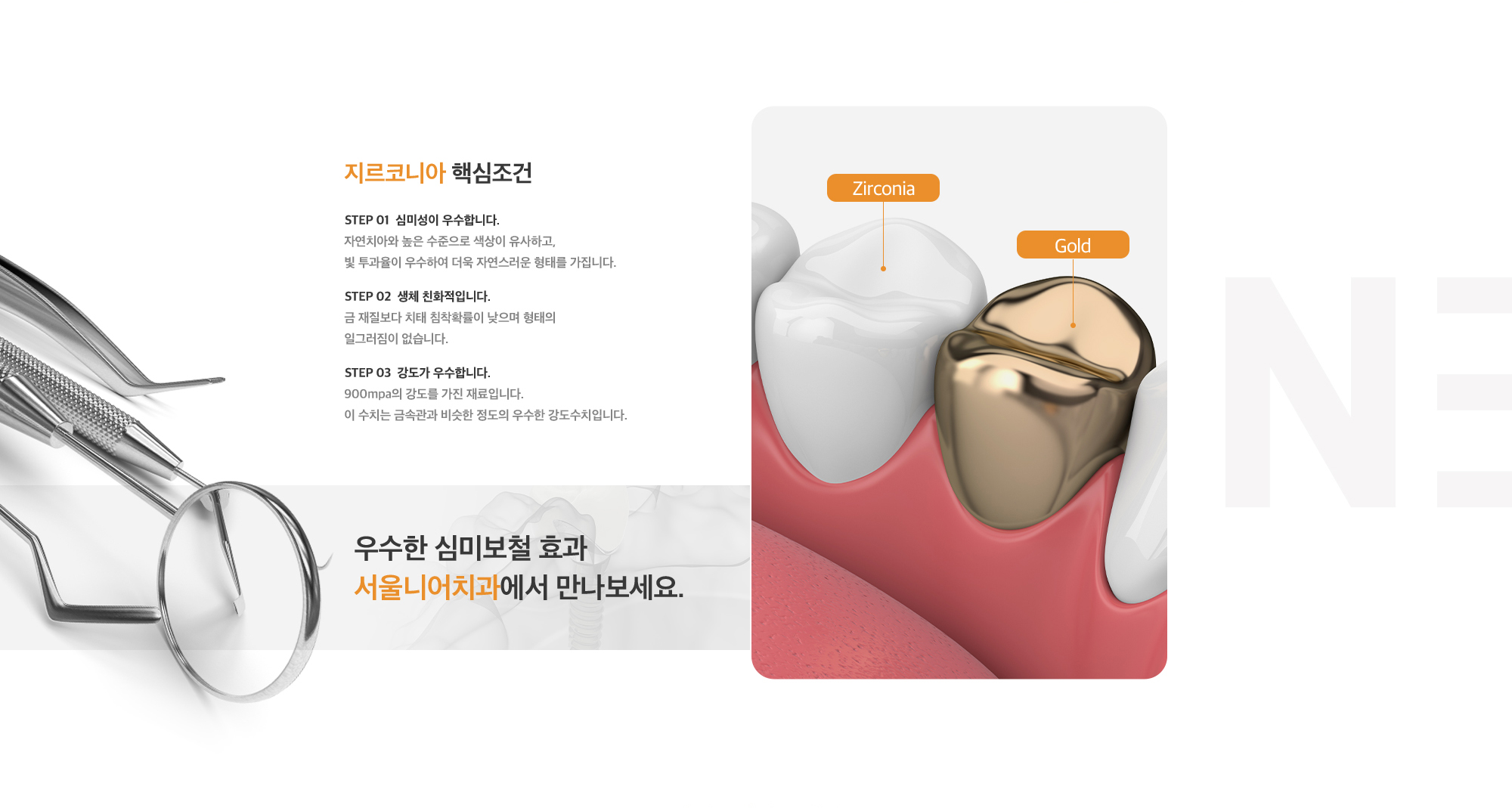 심미 보철