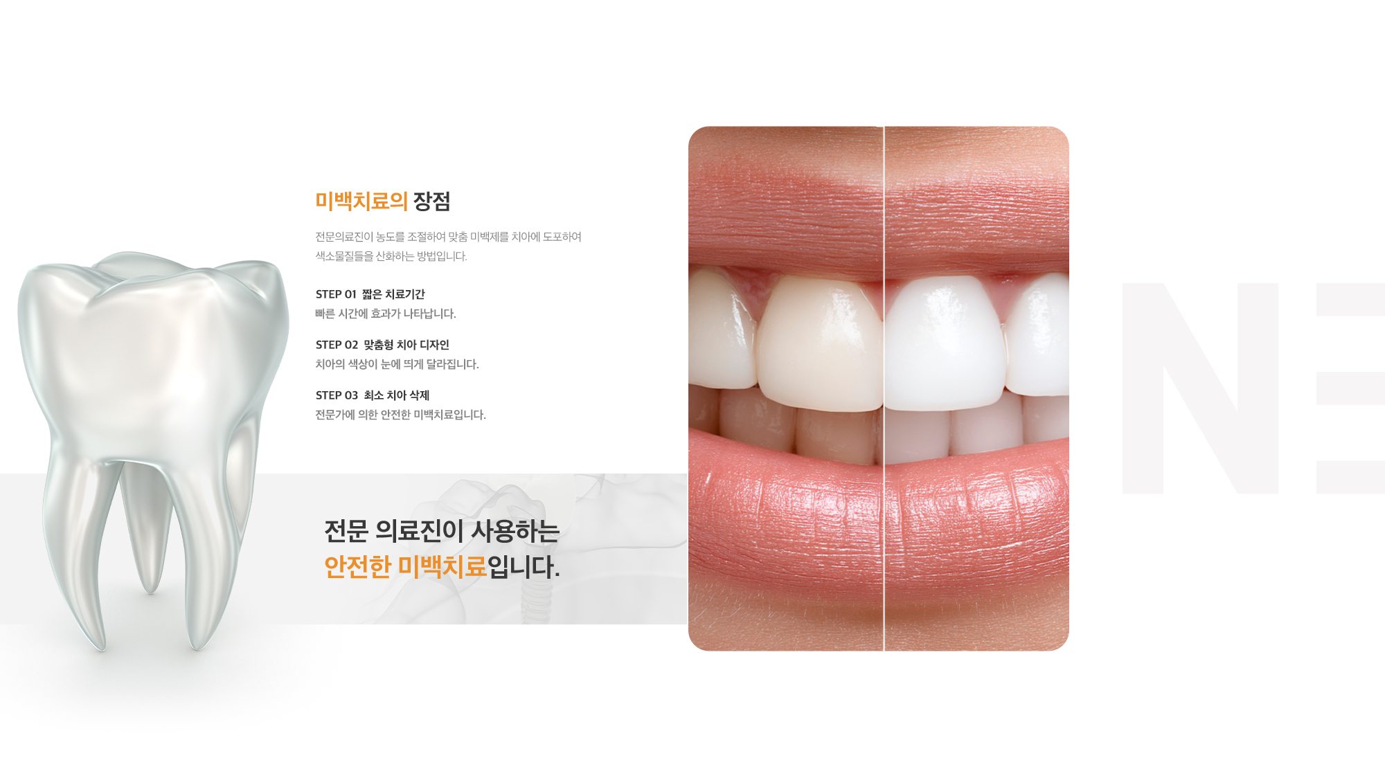 미백치료