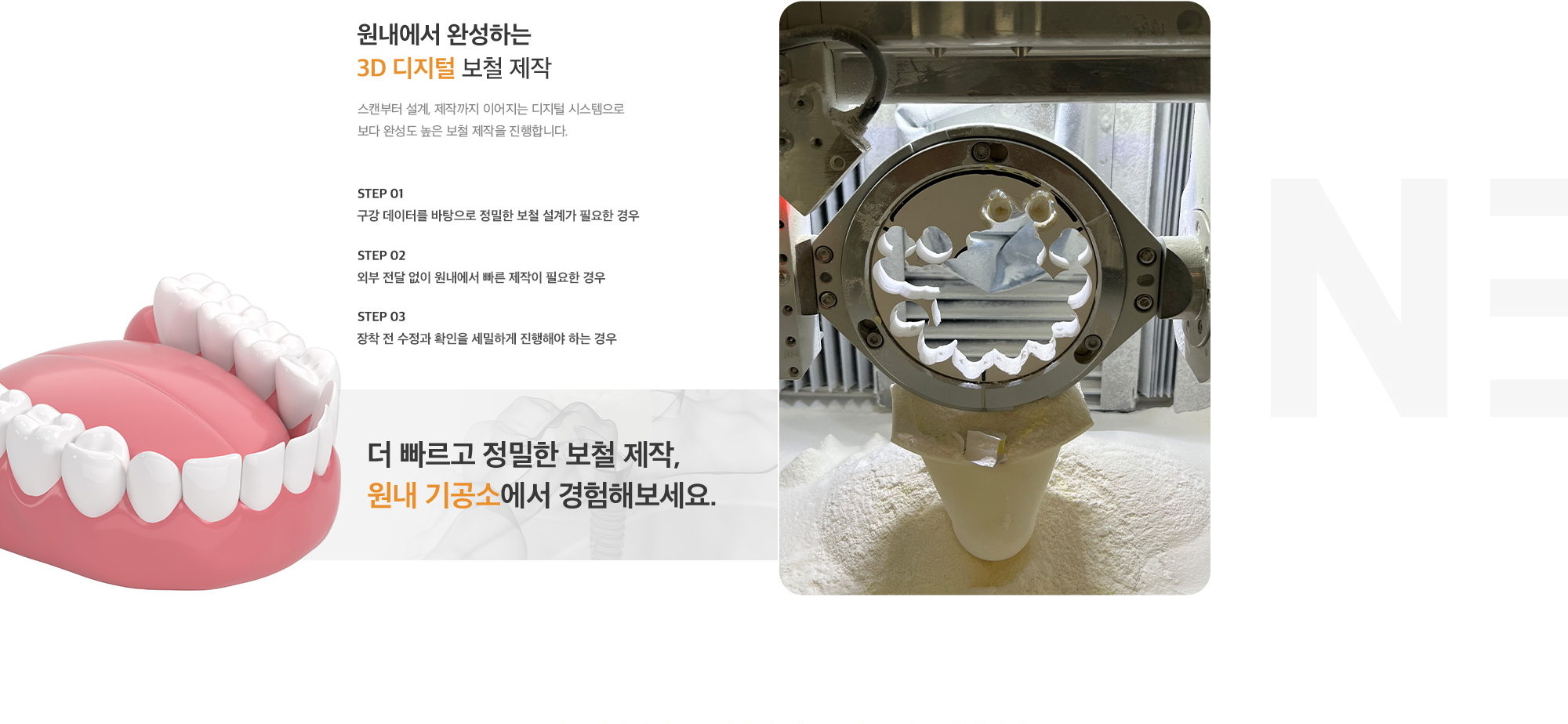 원내에서 완성하는 3D 디지털 보철 제작 스캔부터 설계, 제작까지 이어지는 디지털 시스템으로 보다 완성도 높은 보철 제작을 진행합니다.