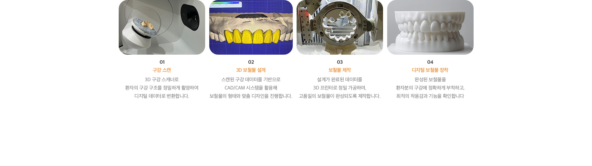 01. 구강 스캔, 02. 3D 보철물 설계, 03. 보철물 제작, 04. 디지털 보철물 장착