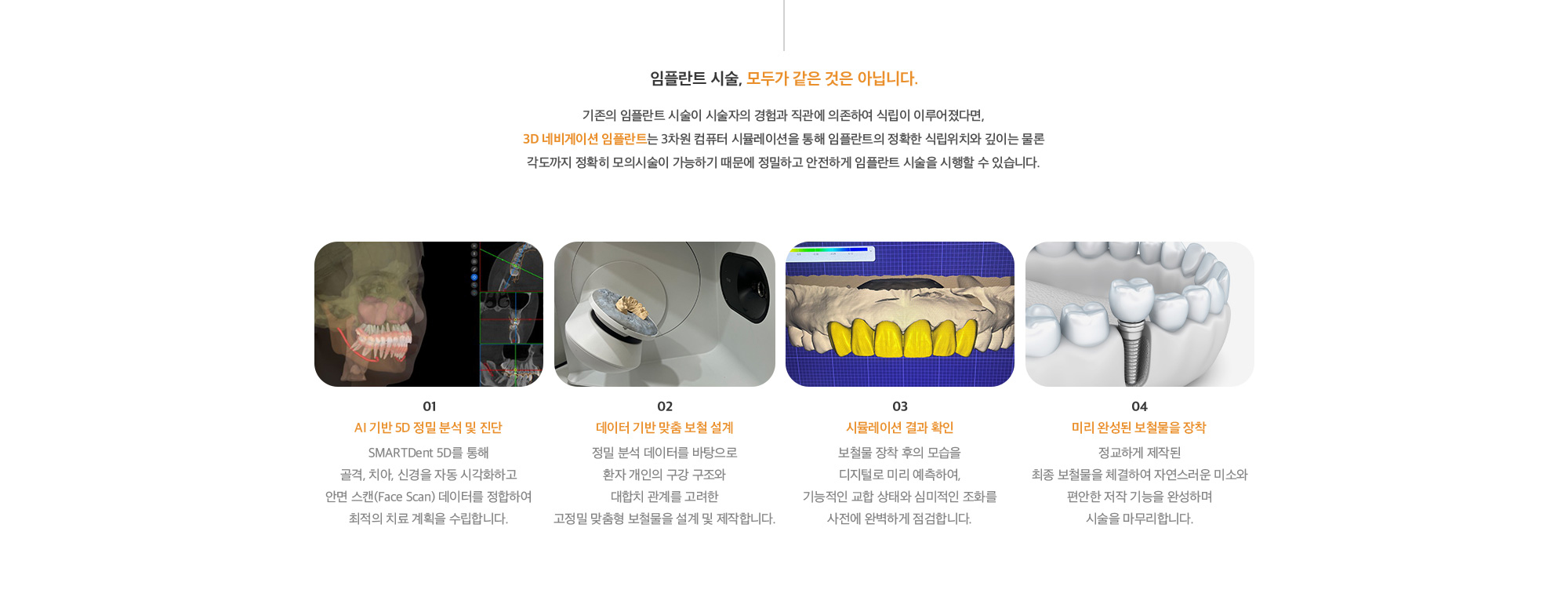 3D 네비게이션 임플란트의 시술과정 : 1. CT상에서 임플란트의 적절한 위치선정, 2. 완성된 맞춤형 가이드를 디자인, 3. 가이드를 통해 작은 절개로 시술, 4. 미리 완성된 보철물을 장착