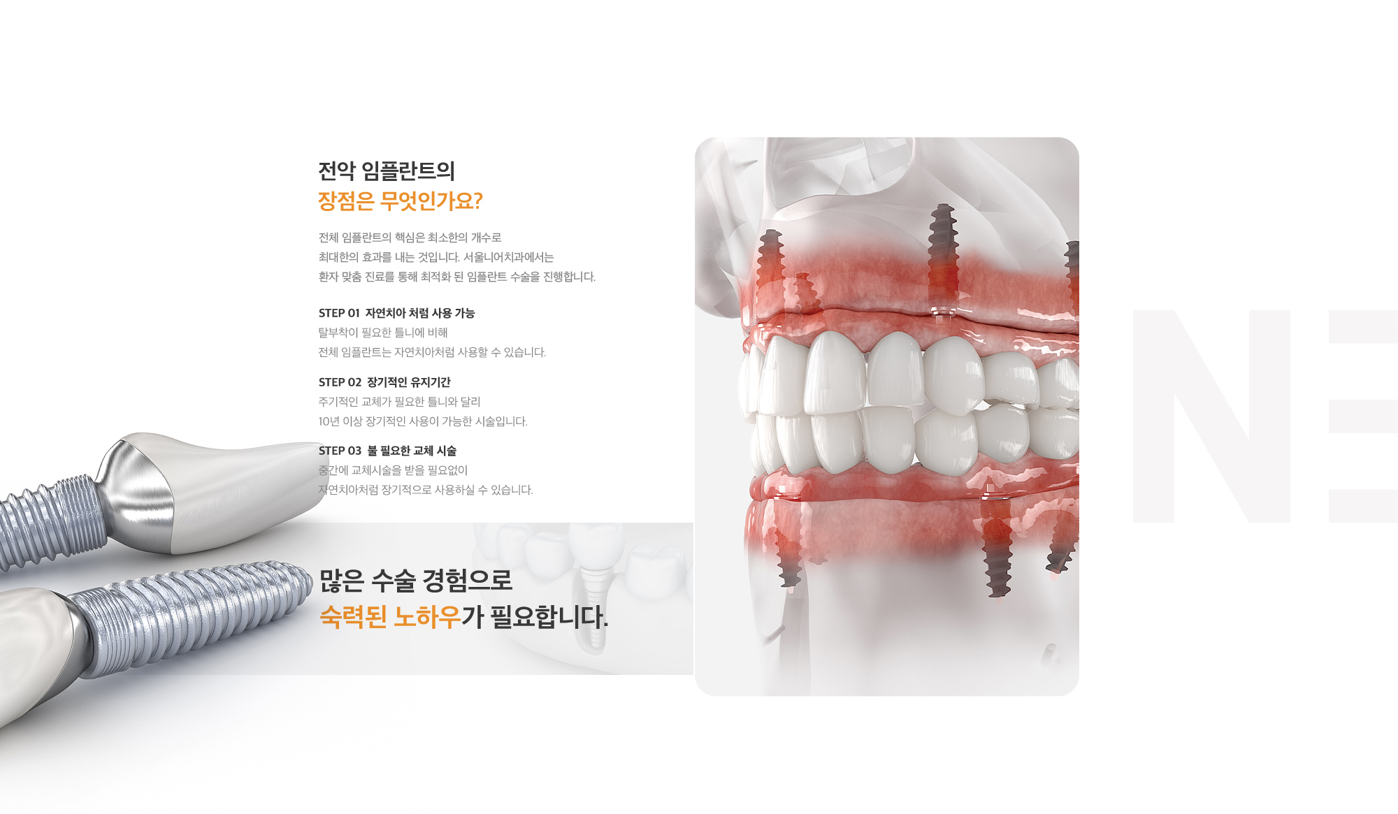 전악 임플란트의 장점 : 자연치아 처럼 사용 가능, 장기적인 유지기간, 불 필요한 교체 시술