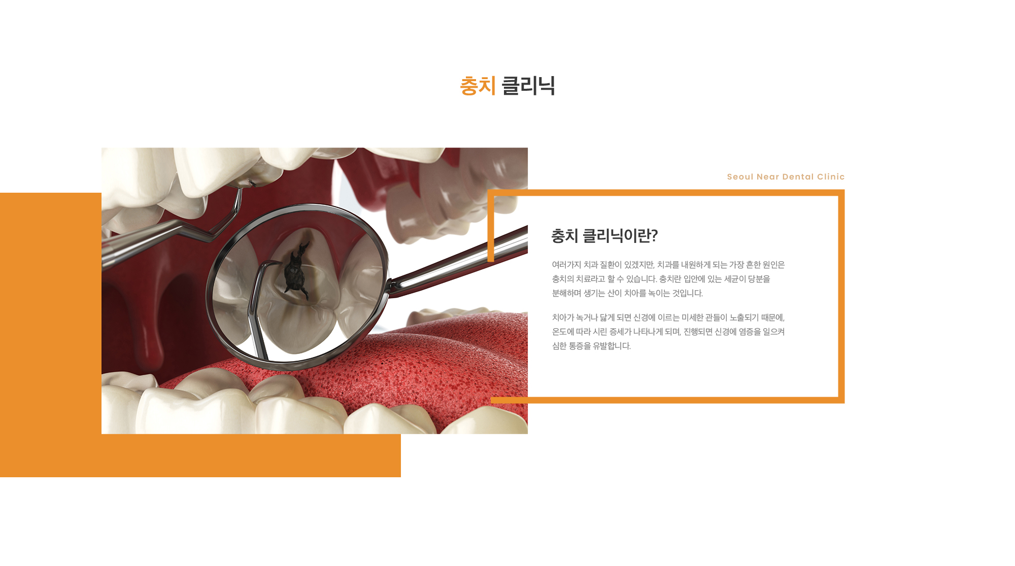 충치 클리닉