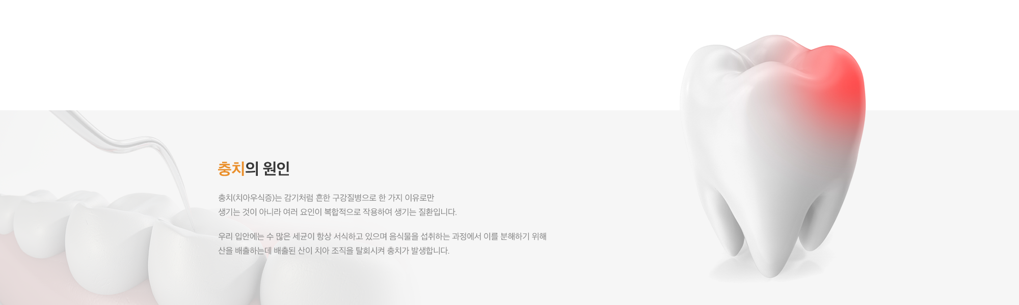 충치 클리닉
