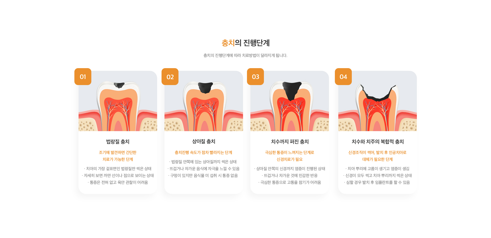 충치 클리닉