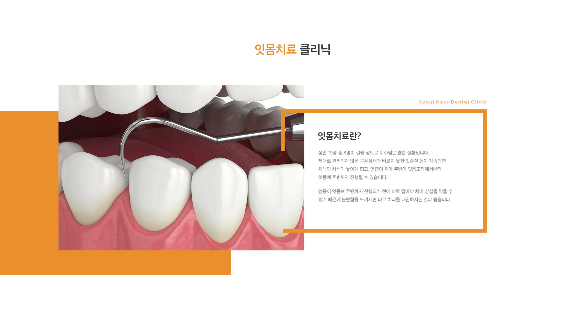 잇몸 치료