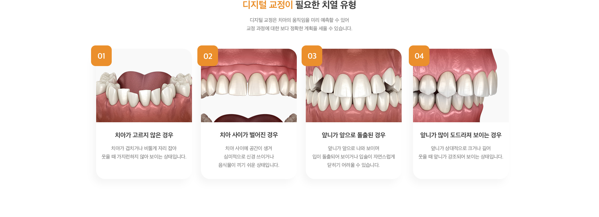 디지털 교정이 필요한 치열 유형 : 1.치아가 고르지 않은 경우, 2. 치아 사이가 벌어진 경우, 3. 앞니가 앞으로 돌출된 경우, 4. 앞니가 많이 도드라져 보이는 경우