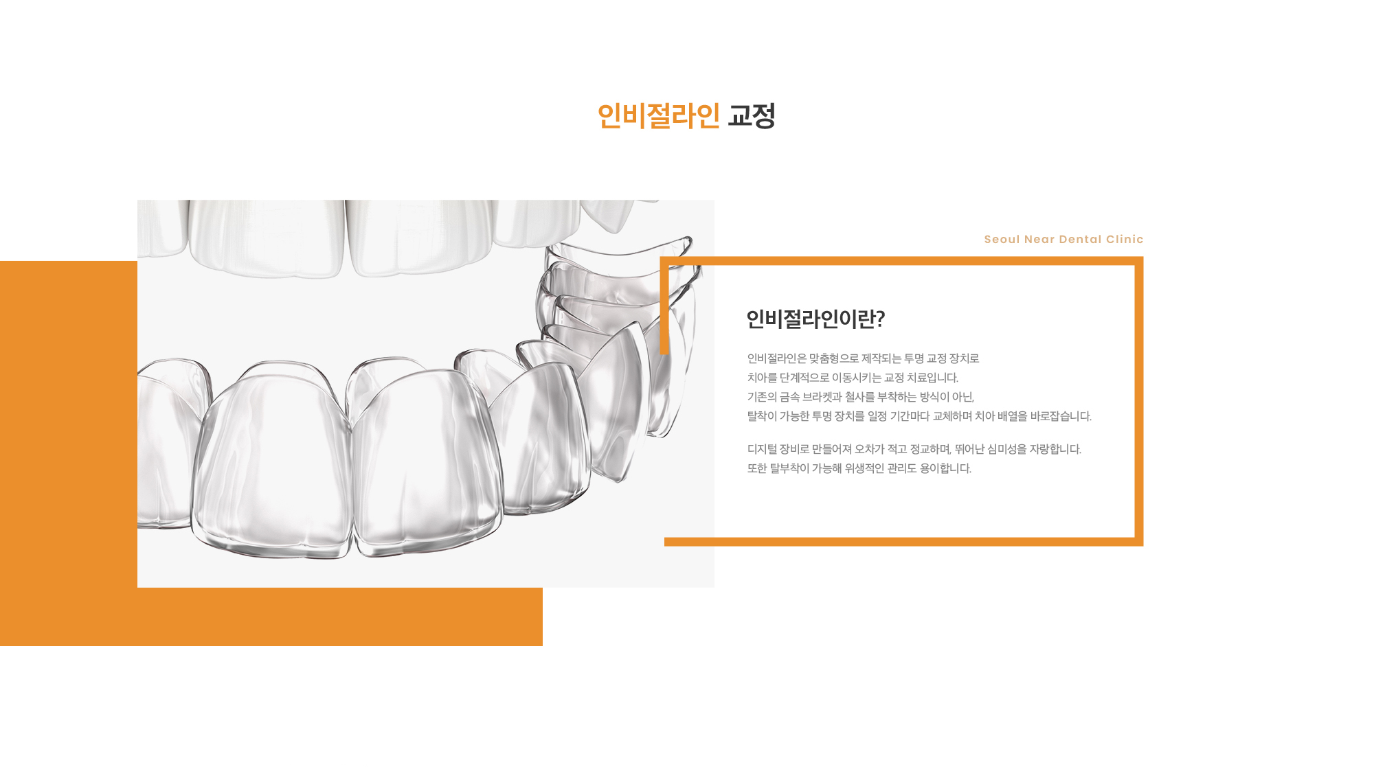 인비절라인이란? 인비절라인은 맞춤형으로 제작되는 투명 교정 장치로 치아를 단계적으로 이동시키는 교정 치료입니다. 기존의 금속 브라켓과 철사를 부착하는 방식이 아닌, 탈착이 가능한 투명 장치를 일정 기간마다 교체하며 치아 배열을 바로잡습니다. 디지털 장비로 만들어져 오차가 적고 정교하며, 뛰어난 심미성을 자랑합니다. 또한 탈부착이 가능해 위생적인 관리도 용이합니다.