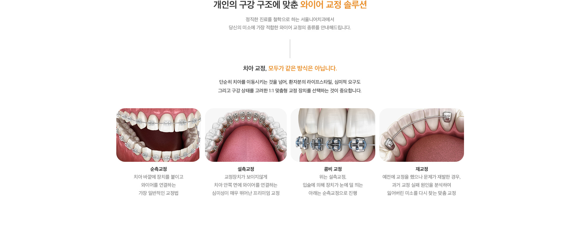 개인의 구강 구조에 맞춘 와이어 교정 솔루션 정직한 진료를 철학으로 하는 오라클치과에서 당신의 미소에 가장 적합한 와이어 교정의 종류를 안내해드립니다. 단순히 치아를 이동시키는 것을 넘어, 환자분의 라이프스타일, 심미적 요구도 그리고 구강 상태를 고려한 1:1 맞춤형 교정 장치를 선택하는 것이 중요합니다.